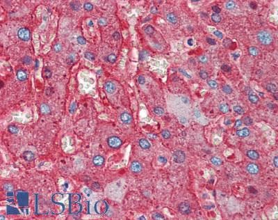 IHC-plus™ SERPINA1 / Alpha 1 Antitrypsin Antibody (N-Terminus)