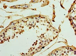 UCP1 / UCP-1 Antibody (aa1-307)