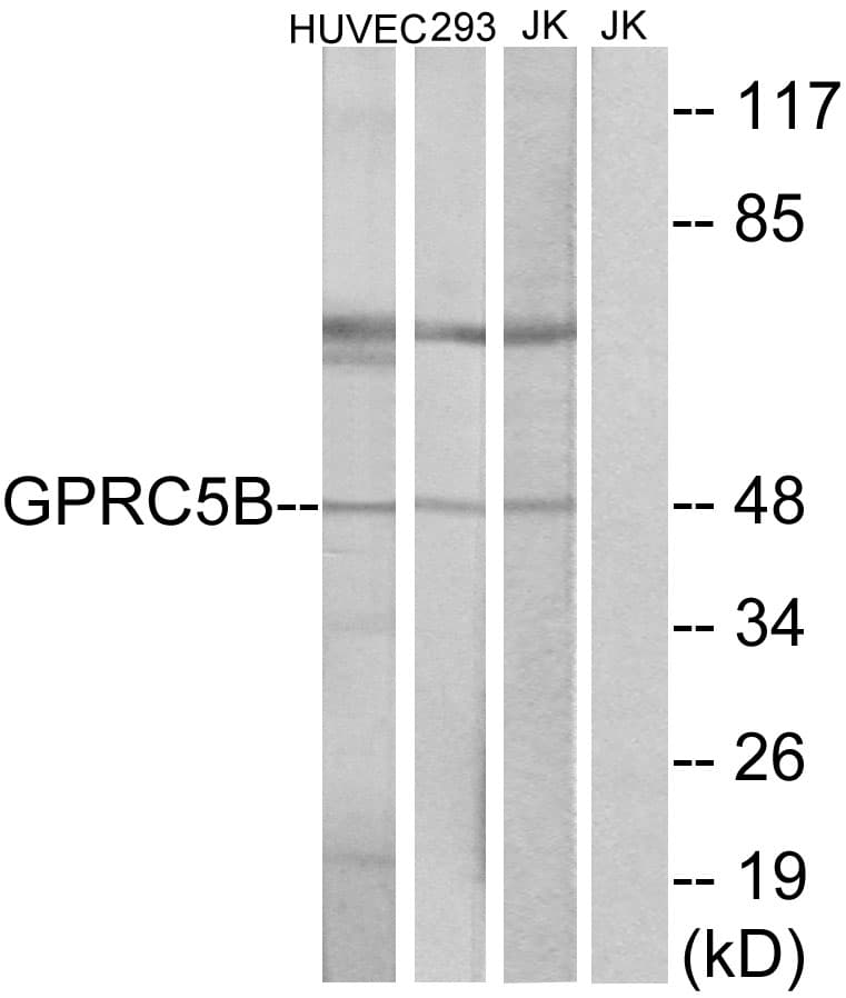 Polyclonal Rabbit anti-Human RAIG2 / GPRC5B Antibody (aa61-110, IF, WB)