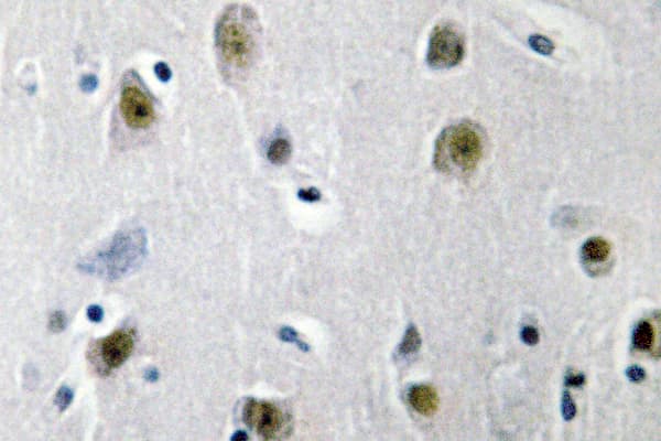ZNF148 / ZBP-89 Antibody (Glu84)