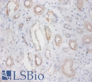 ZNF91 Antibody