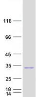 Human RHOE / RND3 Protein (Recombinant Myc-DDK (Flag))