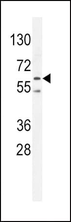 PRKAA2 / AMPK Alpha 2 Antibody (Thr172)