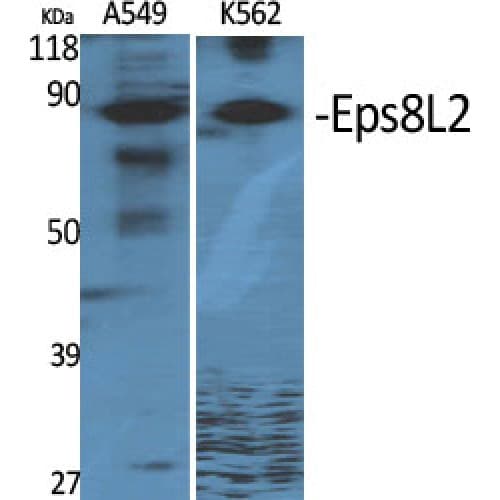 Polyclonal Rabbit anti-Human EPS8L2 Antibody (10-90 aa, N-terminal, IHC, IF, WB)