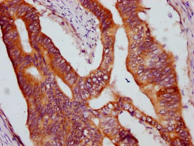 Polyclonal Rabbit anti-Human CCM1 / KRIT1 Antibody (IHC)