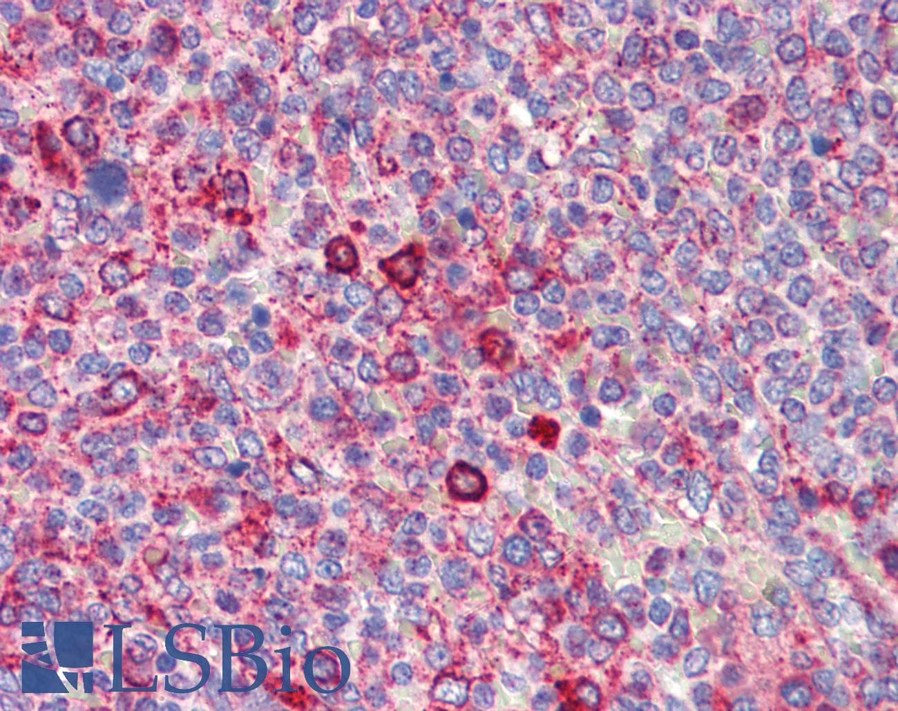 Polyclonal Rabbit anti-Human BCL11A Antibody (N-Terminus, IHC, WB)