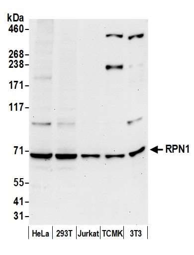 RPN1 / Ribophorin I Antibody (aa557-607)