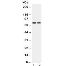 KCNQ1 / KVLQT1 Antibody