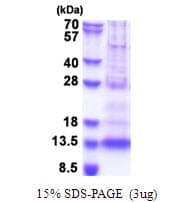 Human PF4V1 Protein (Recombinant His)