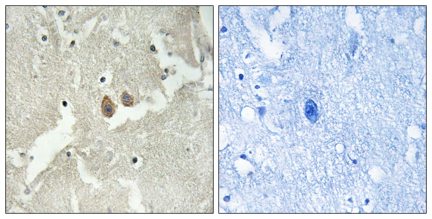 HMP19 Antibody (aa33-82)