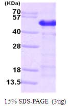 Human CALU / Calumenin Protein (Recombinant His)