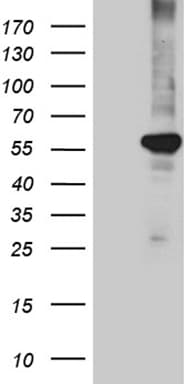 PPARD / PPAR Delta Antibody (aa1-244, clone OTI4D10, Carrier-free)
