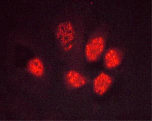 Polyclonal Rabbit anti-Human PPARG / PPAR Gamma Antibody (phospho-Ser112, IHC, IF, WB)