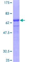 Human CMT2 / MAD2L1BP Protein (Recombinant GST)