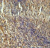 MEF2A / MEF2 Antibody (aa453-479)