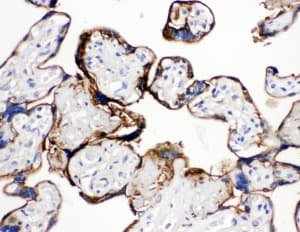 ANXA1 / Annexin A1 Antibody (aa3-24)