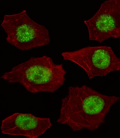 LMO4 Antibody (aa104-131)
