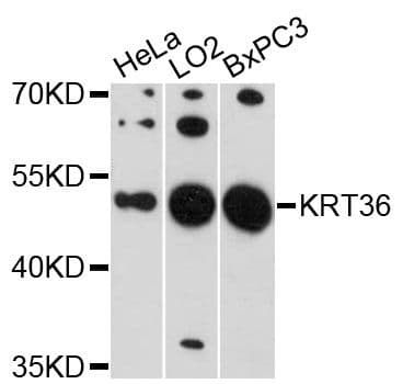 KRT36 / Keratin 36 / KRTHA6 Antibody