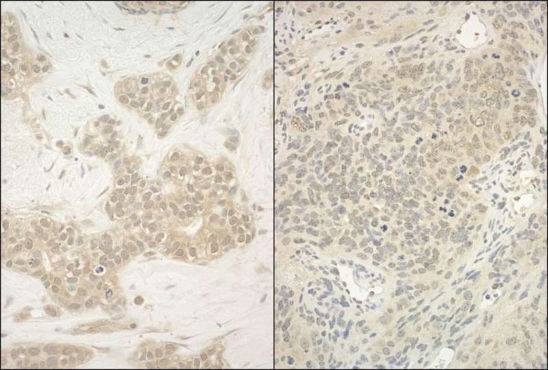 Polyclonal Rabbit anti-Human YY1 Antibody (aa50-100, IHC, WB)