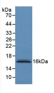 S100A6 / Calcyclin Antibody (aa1-90, Cy3)
