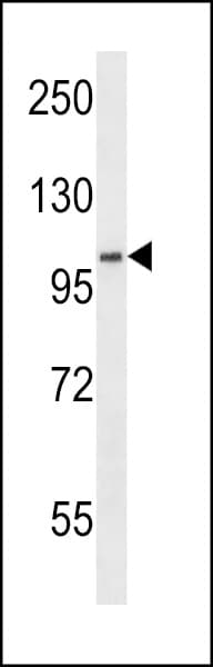 SDCCAG1 / NEMF Antibody (aa236-264)