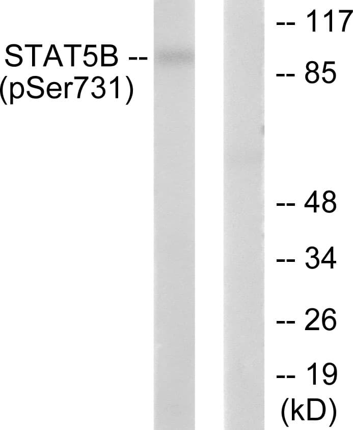 STAT5B Antibody (phospho-Ser731)