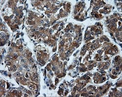 TUBA8 / Tubulin Alpha 8 Antibody (clone OTI2E9)