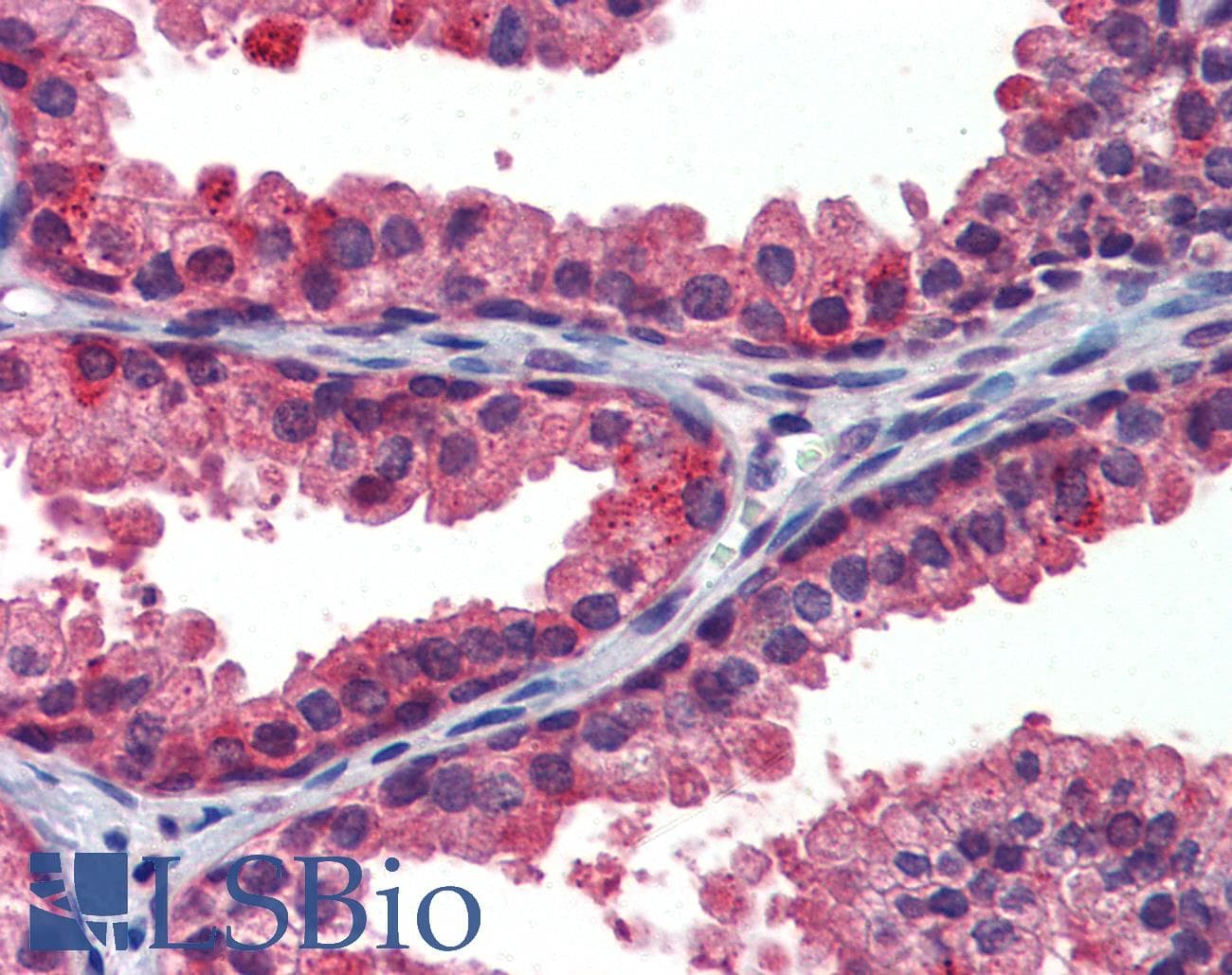 IHC-plus™ Polyclonal Rabbit anti-Human KIAA1840 / SPG11 Antibody (IHC, WB)