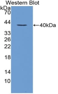 Loricrin Antibody (aa210-295)