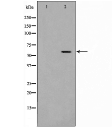 CYP4Z1 Antibody