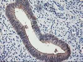ALS2CR1 / NIF3L1 Antibody (clone OTI1F6)