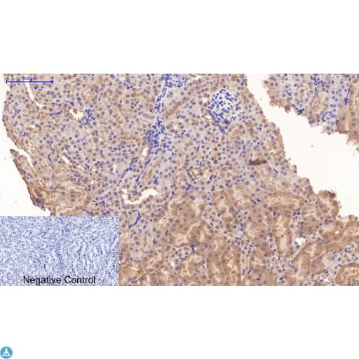 TUBE1 / Tubulin Epsilon Antibody