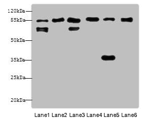 IHC-plus™ CTNNB1 / Beta Catenin Antibody