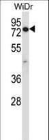 Polyclonal Rabbit anti-Human CCDC22 Antibody (aa530-558, IHC, WB)
