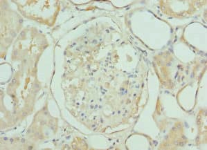 Polyclonal Rabbit anti-Human LIMS1 / PINCH Antibody (IHC, IF)