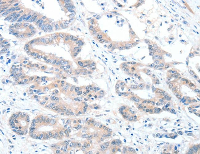 RALDH2 / ALDH1A2 Antibody