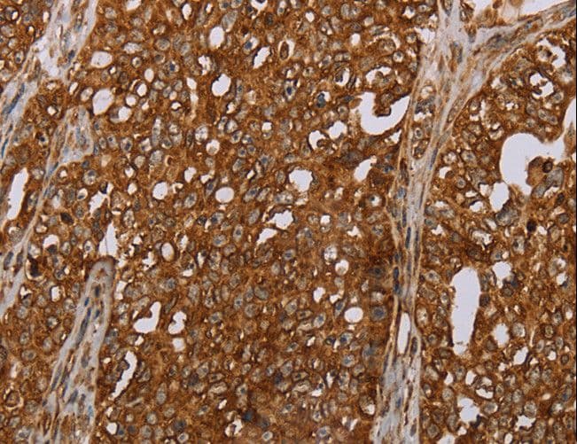 ERRFI1 / RALT Antibody