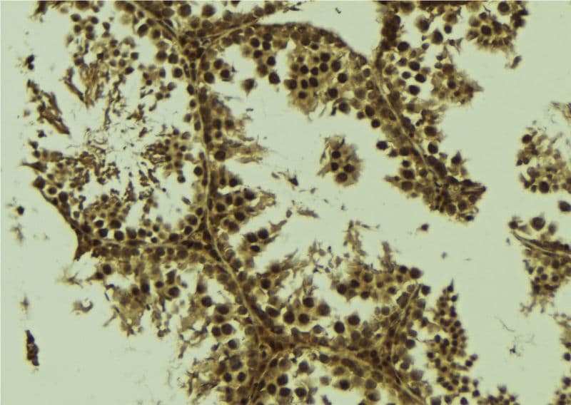 EEF1D Antibody