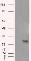 NIT2 Antibody (clone OTI3D5)