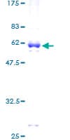 Human HCCS Protein (Recombinant GST)