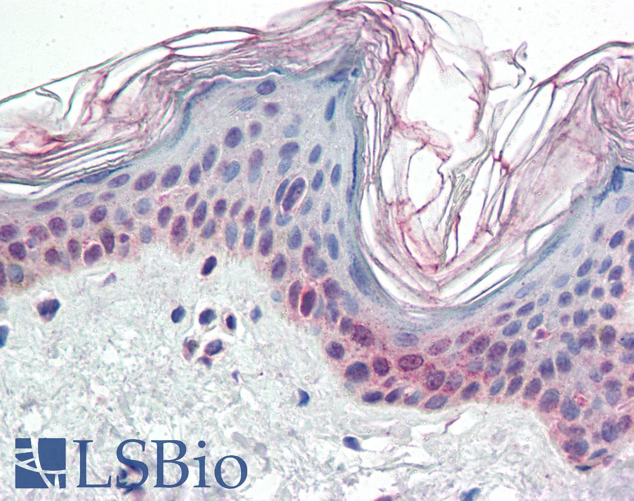 IHC-plus™ PARP2 Antibody (aa389-401)
