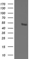 STK38L / NDR2 Antibody (clone OTI4D8)