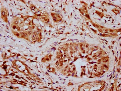 Polyclonal Rabbit anti-Human BAF60B / SMARCD2 Antibody (IHC, WB)