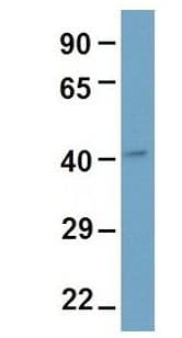 DDB2 Antibody (aa351-400)