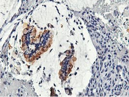 CAPN9 / Calpain 9 Antibody (clone OTI2G1)