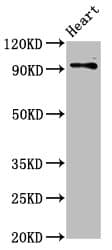 DLG2 / PSD93 Antibody