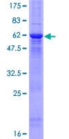 Human F12 / Factor XII Protein (Recombinant GST)