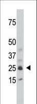 SULT1C2 / Sulfotransferase 1C2 Antibody (aa95-127)