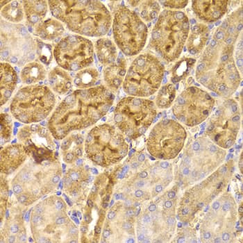 FDPS Antibody