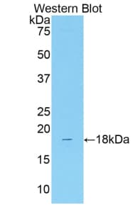 SLC12A3 / TSC Antibody (aa3-146)